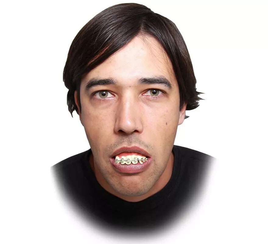 Dentadura con Brakets
