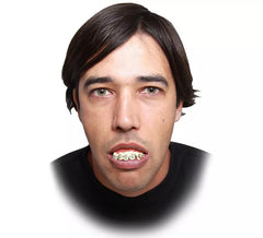 Dentadura com Brakets