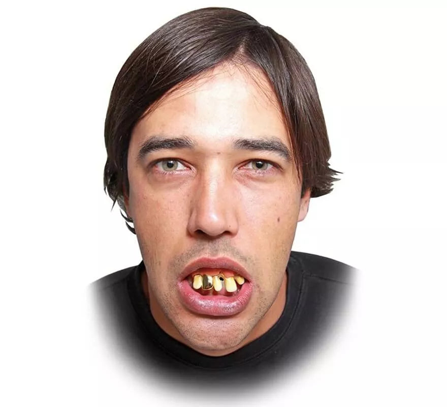 Translation missing: pt-PT.Dentadura con diente de oro