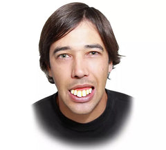 Prótese com dentes extra grandes